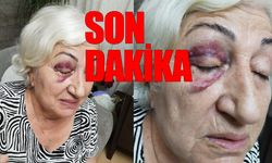 Meclis üyesinin amcası, CHP'li kadına yumruk attı