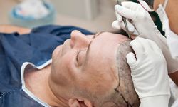 Level Hospital’de, Saç Ekimi Merkezi açıldı