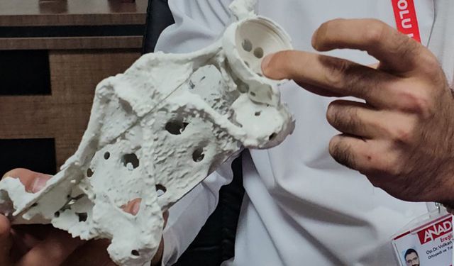 60 yaşındaki kadın 3D yazıcıyla üretilen kalça proteziyle sağlığına kavuştu