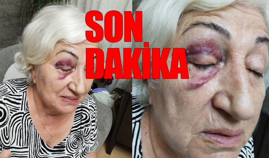 Meclis üyesinin amcası, CHP'li kadına yumruk attı